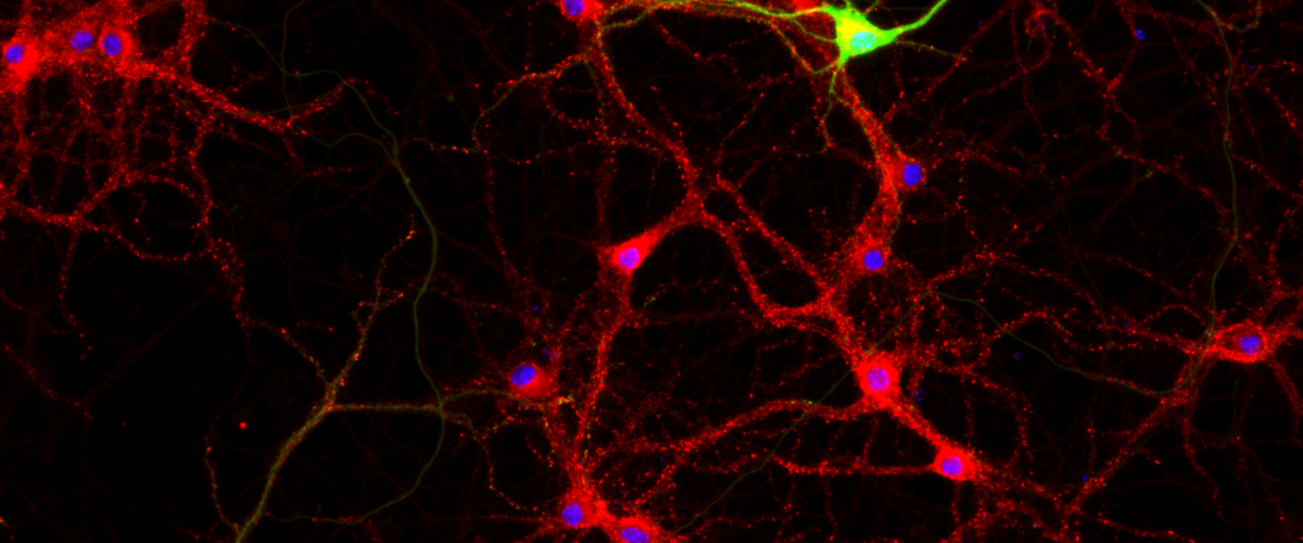 PSD-95 stained cortical neurons DIV 14 DIV 21_C1 DIV 21 GFP 2_overlay