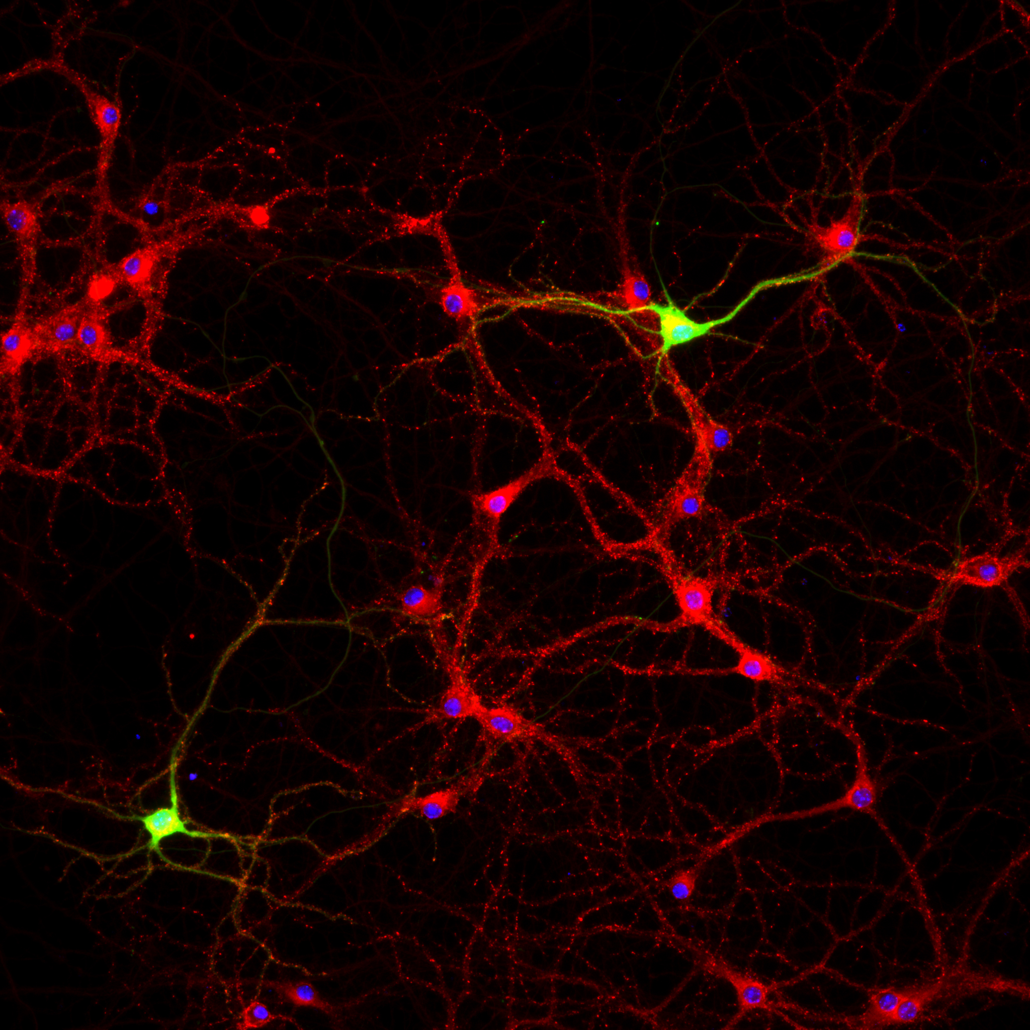 PSD-95 stained cortical neurons DIV 14 DIV 21_C1 DIV 21 GFP 2_overlay
